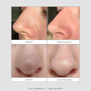 Patchs Nez Purifiants - Pack de 10 Patchs