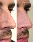 Patchs Nez Purifiants - Pack de 10 Patchs