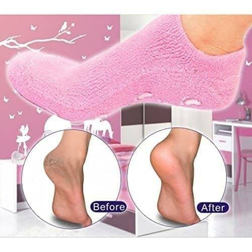 Chaussettes en gel SPA - Silicone | VIEACT™