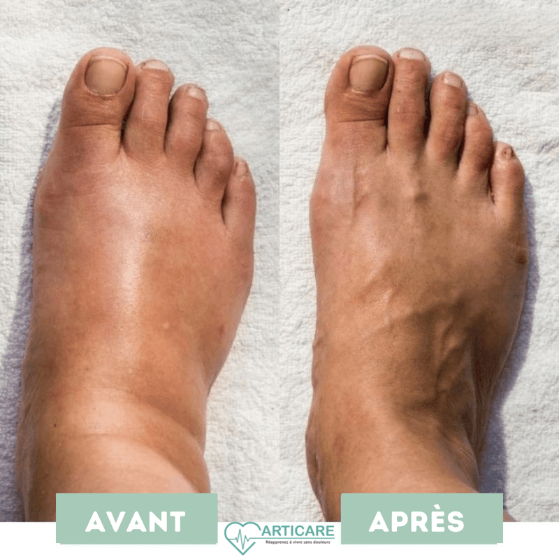 Mass'Pieds Revitalisant EMS | VIEACT™